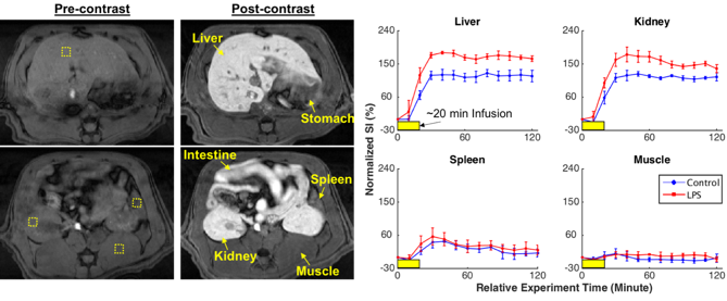 Systemmic Inflamation graphs