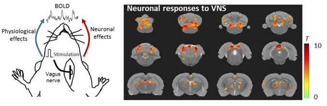 Pictures of Neural responses to VNS