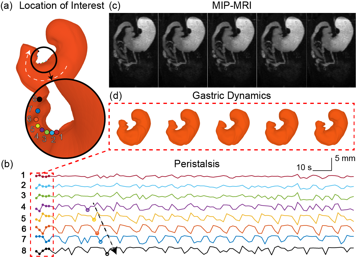 Gastric Dynamics breakdown with MRI and peristalsis on graph